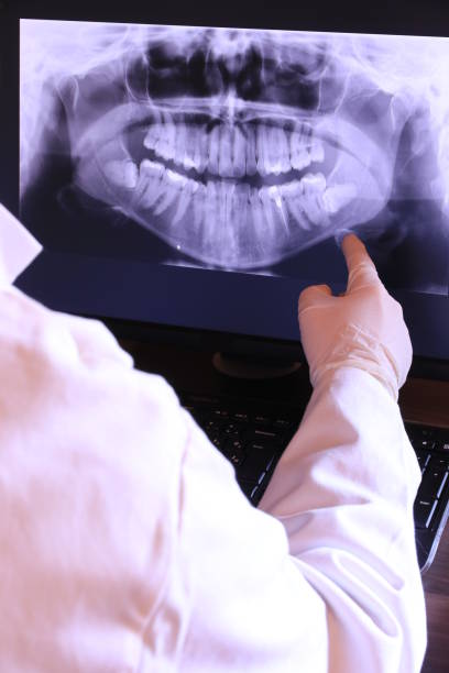 Best Emergency Dental Care for Broken or Chipped Teeth in Four Corners, MD