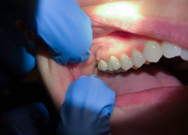 Best Emergency TMJ Treatment in Four Corners, MD