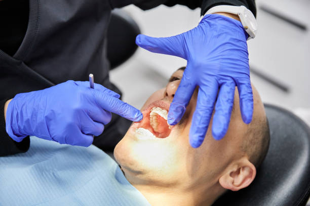 Best Emergency Tooth Extraction in Four Corners, MD
